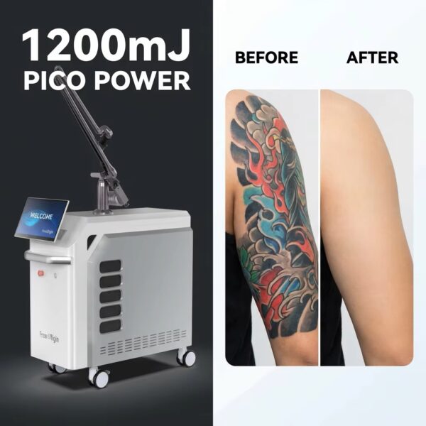 Professional Picosecond Q-Switch Laser Machine (JT MED P-Series)