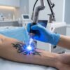 Professional Picosecond Q-Switch Laser Machine (JT MED P-Series)