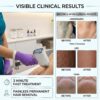 Professional Diode Laser Hair Removal Machine for Medical Aesthetic Clinics | JONTELASER