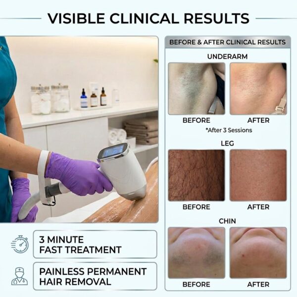 Professional Diode Laser Hair Removal Machine for Medical Aesthetic Clinics | JONTELASER